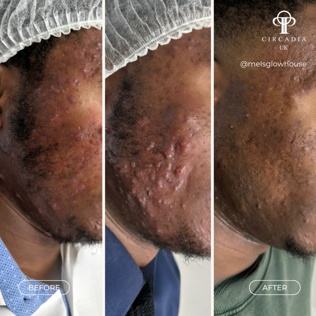 Skin Transformations - Circadia UK